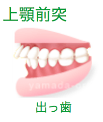 保険が使える顎変形症について大阪のヤマダ矯正歯科 保険適応